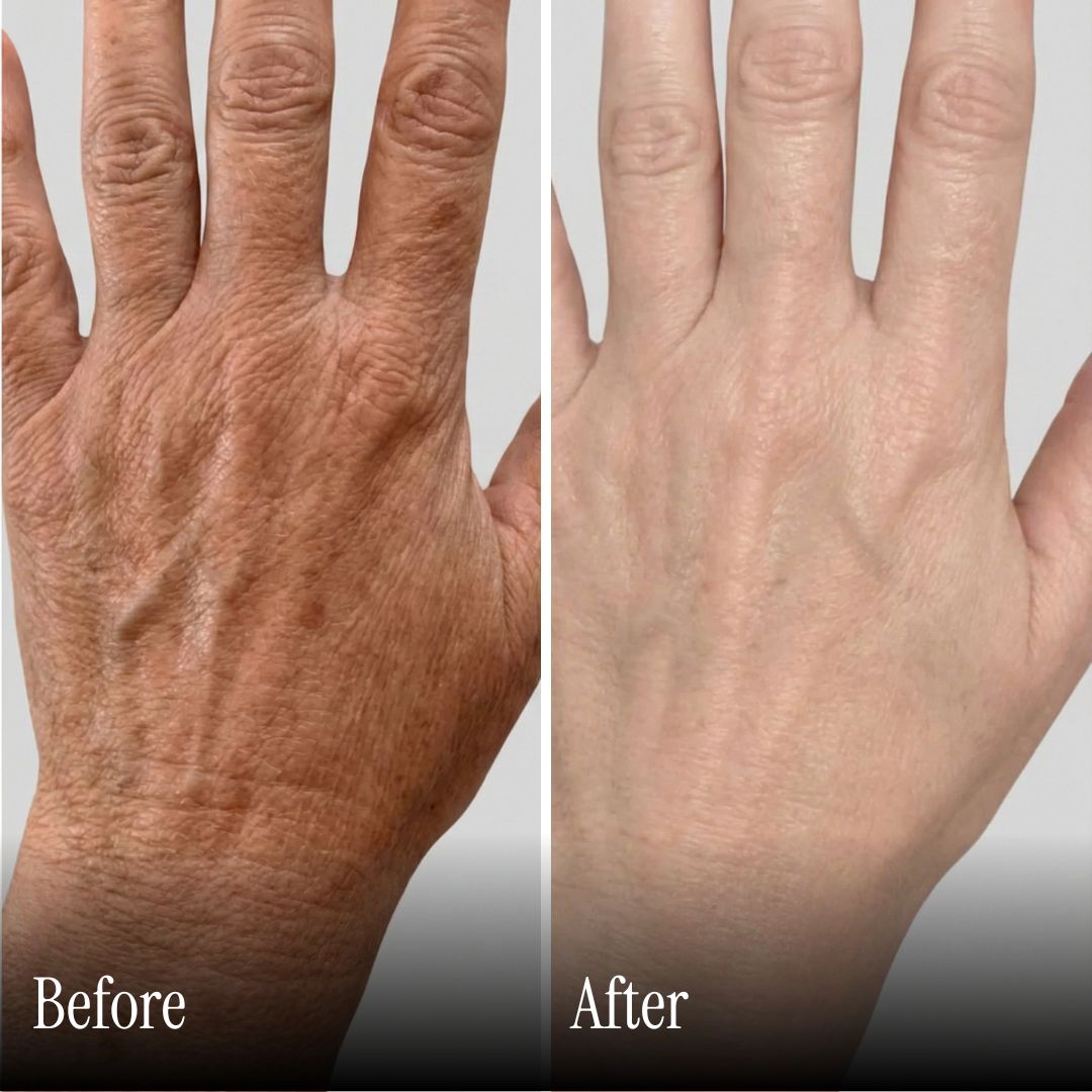 Wireless Red Light Therapy Heating Gloves